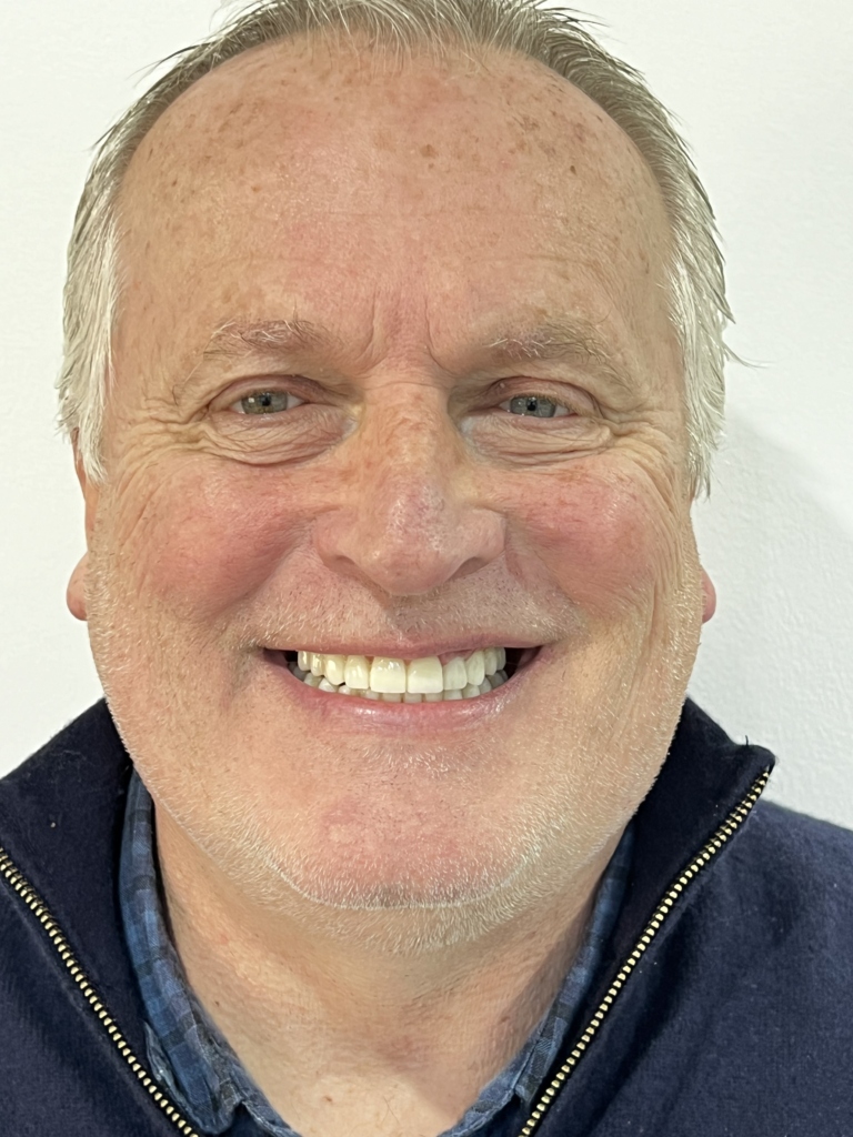 Teeth in a day with guided implants - After