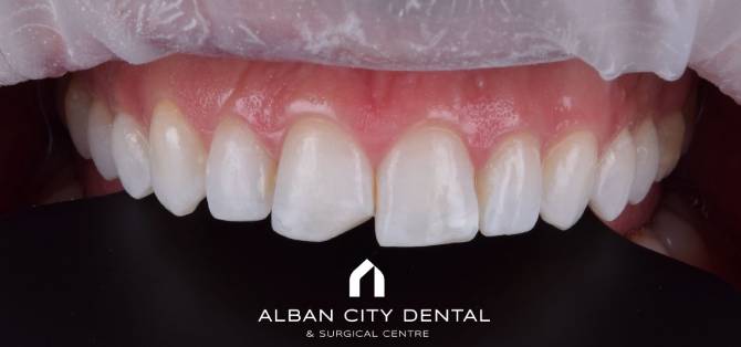 Edge repair - before