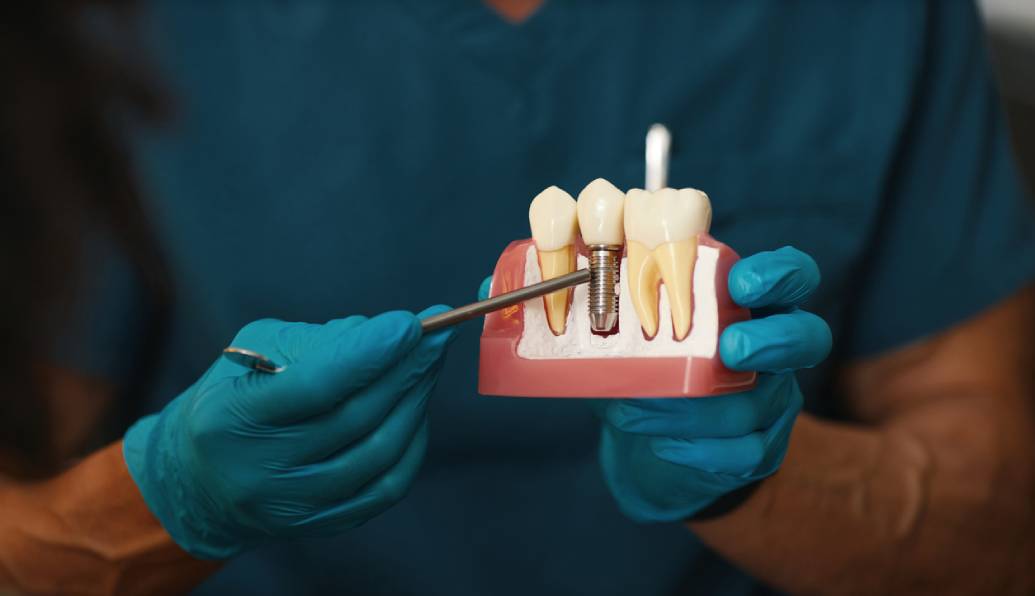 dental implant consultation